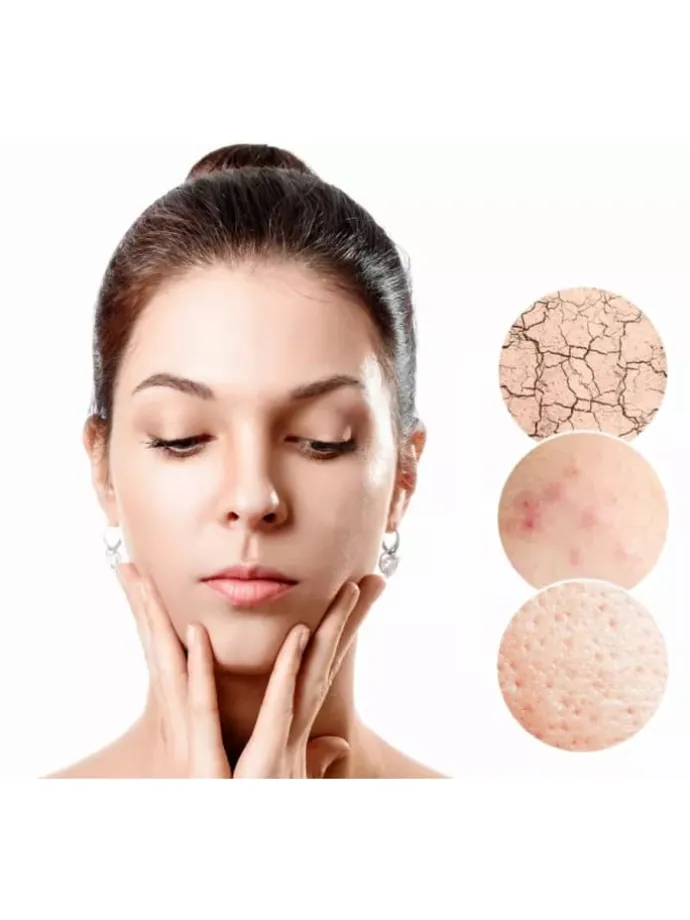 Ultraschall Gerät Gesichtspeeling Gesichtsreinigung 3 in 1 Massage