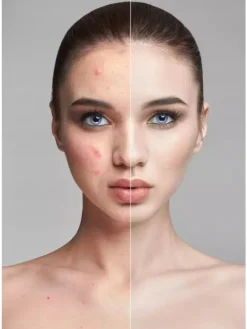Ultraschall Gerät Gesichtspeeling Gesichtsreinigung 3 in 1 Massage