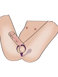 Vibrator Remote Controlled Couple's Vibrator in lila